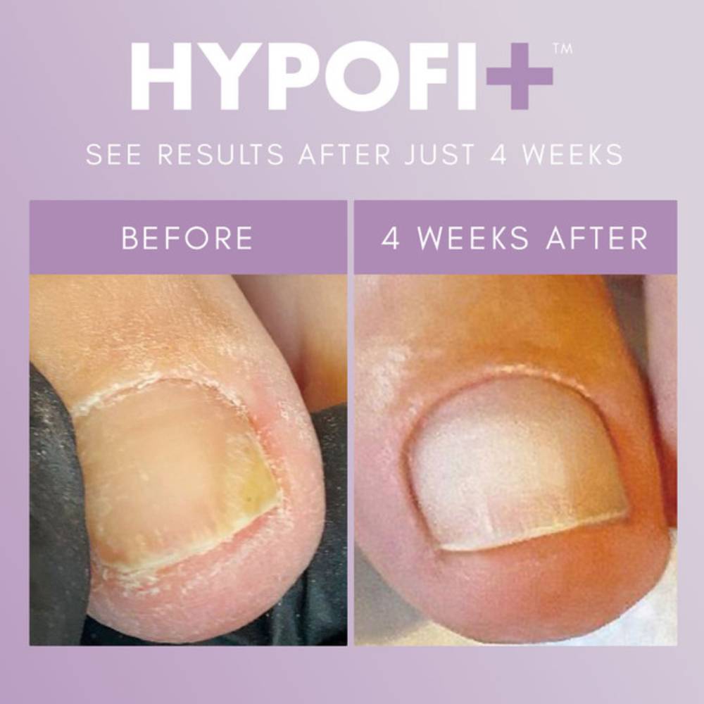 The GelBottle Hypofix Primer 20ml