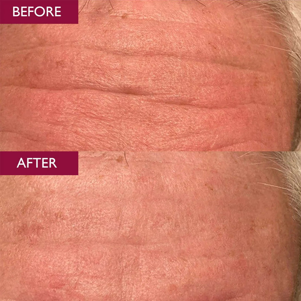 SKINICIAN Lift & Glow Advanced Gift Set