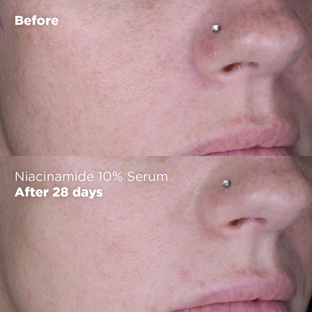 Skin Republic Niacinamide 10% 30ml