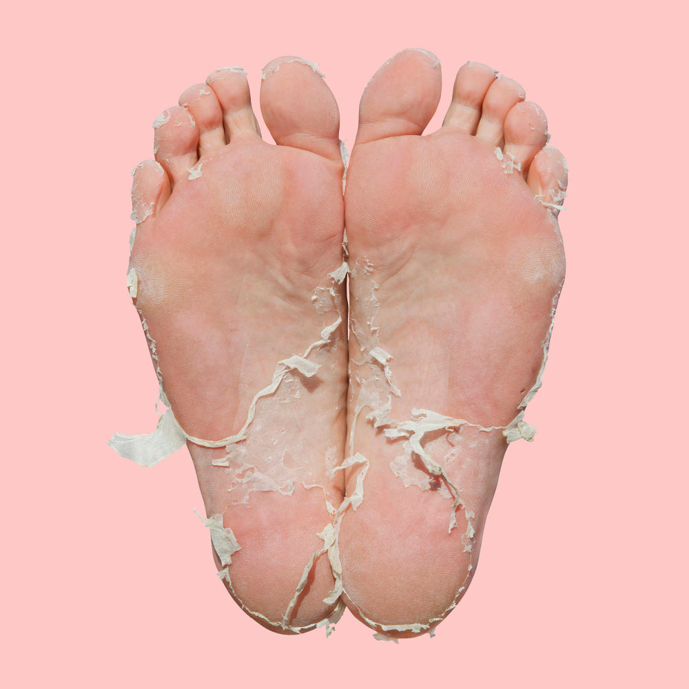 Skin Republic Pedi Peel Max Foot Mask 40ml