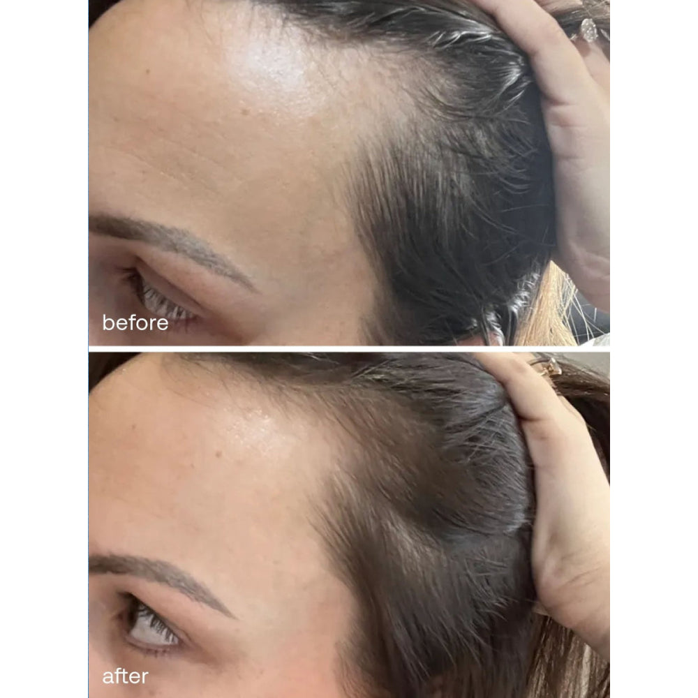 UKHAIR Hair Growth Serum 30ml