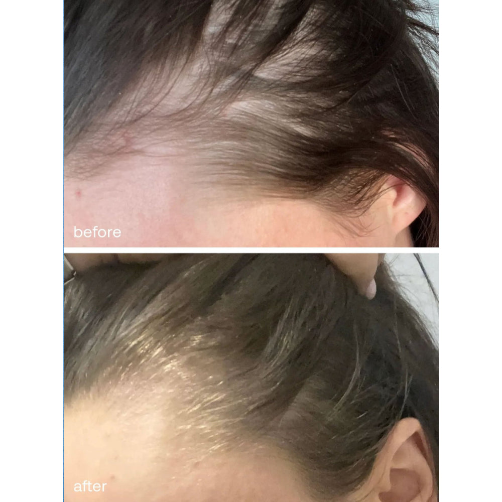 UKHAIR Hair Growth Serum 50ml