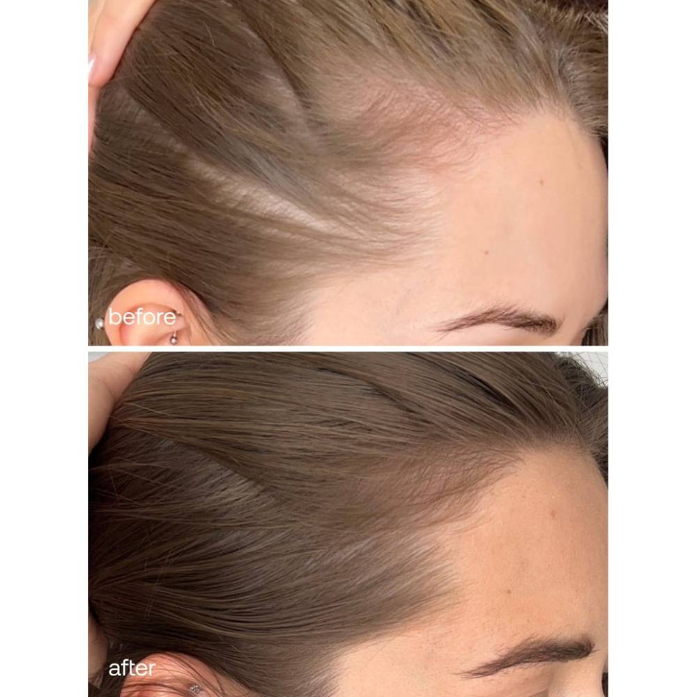 UKHAIR Advanced Hair Supplements (60)