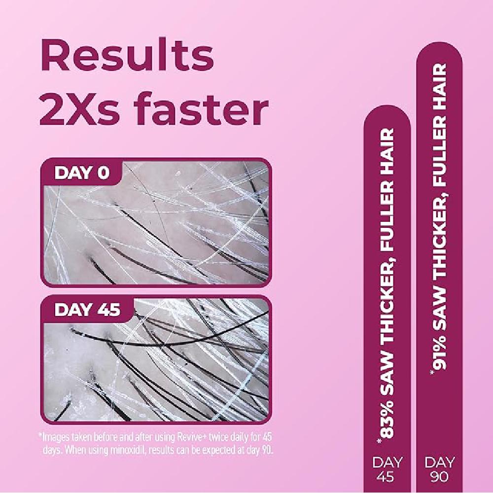 BosleyMD Revive+ Hair Regrowth Treatment Foam for Women 60ml