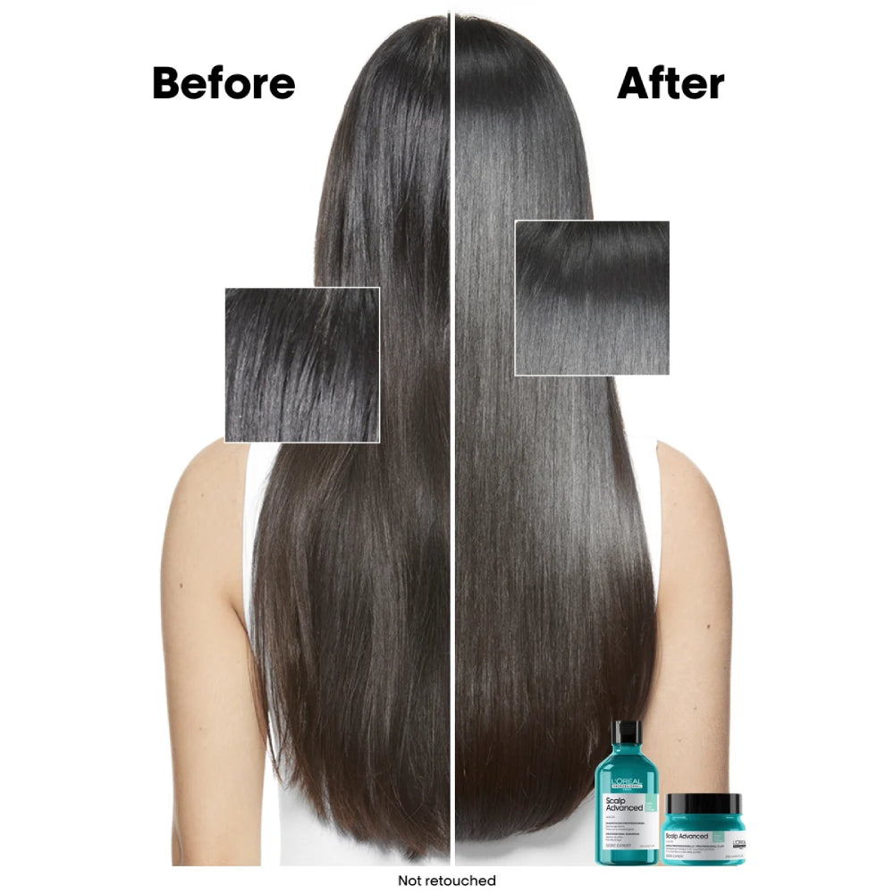 L'Oreal Serie Expert Scalp Advanced Anti-Oiliness Dermo-Purifiant Shampoo 500ml