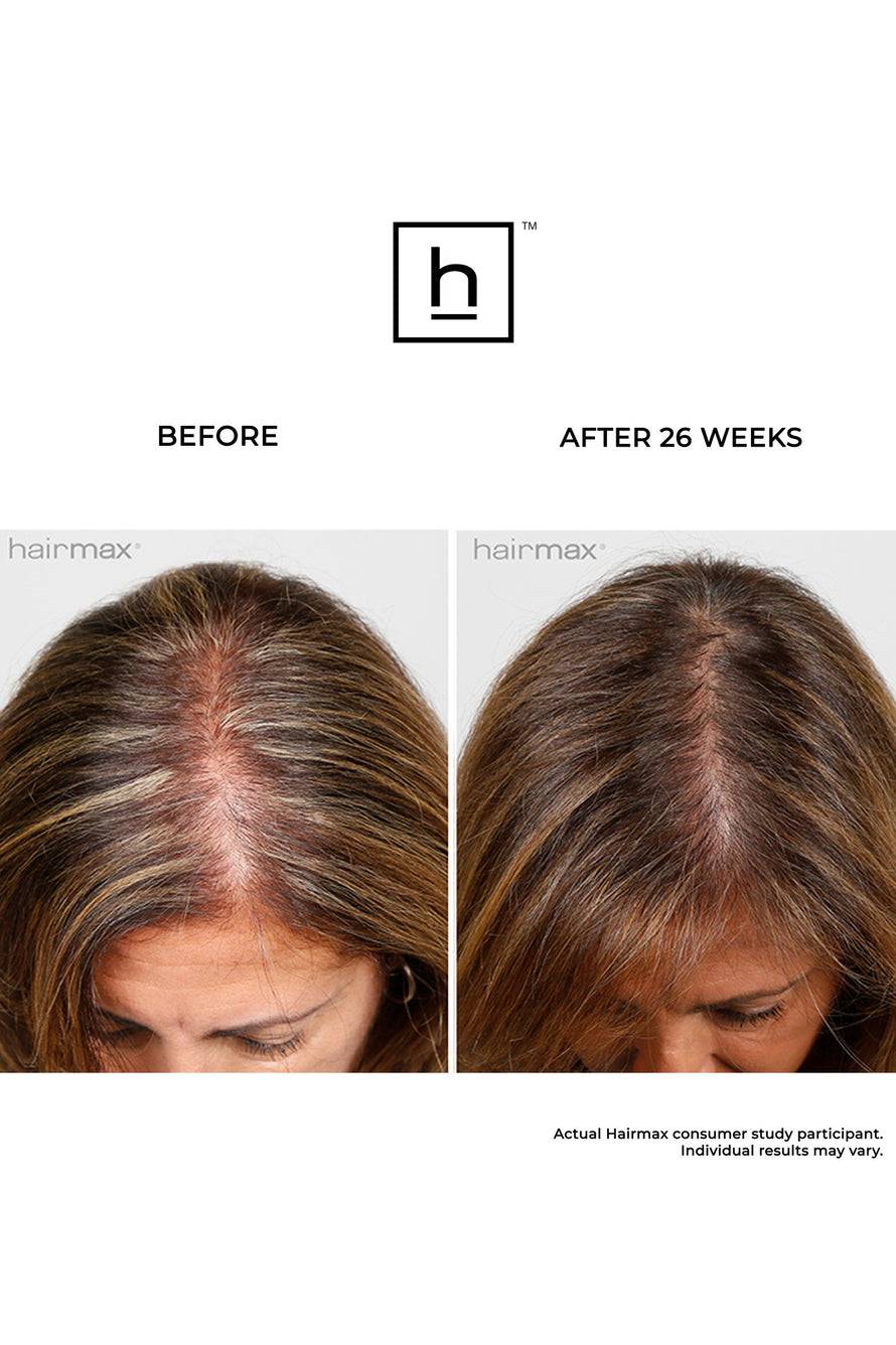 HairMax Ultima 9 Lasercomb