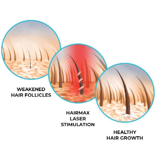 HairMax Powerflex 272 Laser Cap