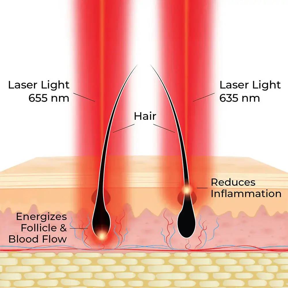 HairMax Actonis 18 Dual Action Lasercomb