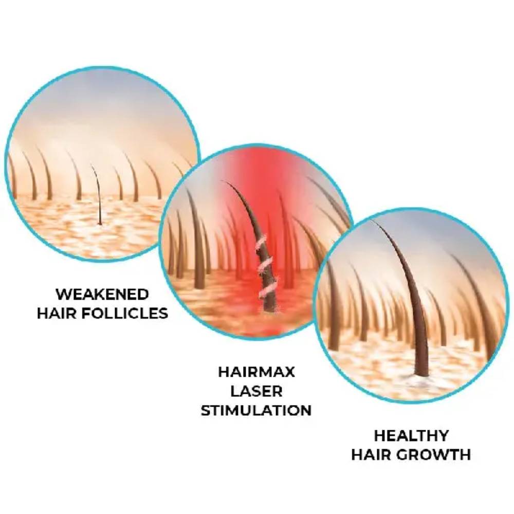 HairMax Regrow MD Laser 272