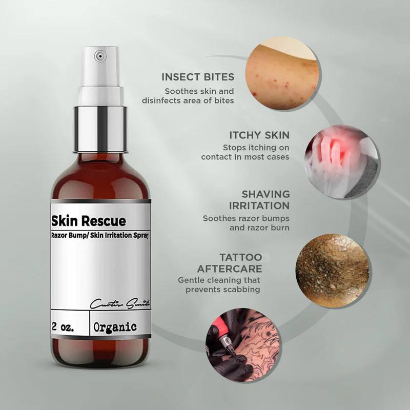 Xotics Skin Rescue Spray 59ml