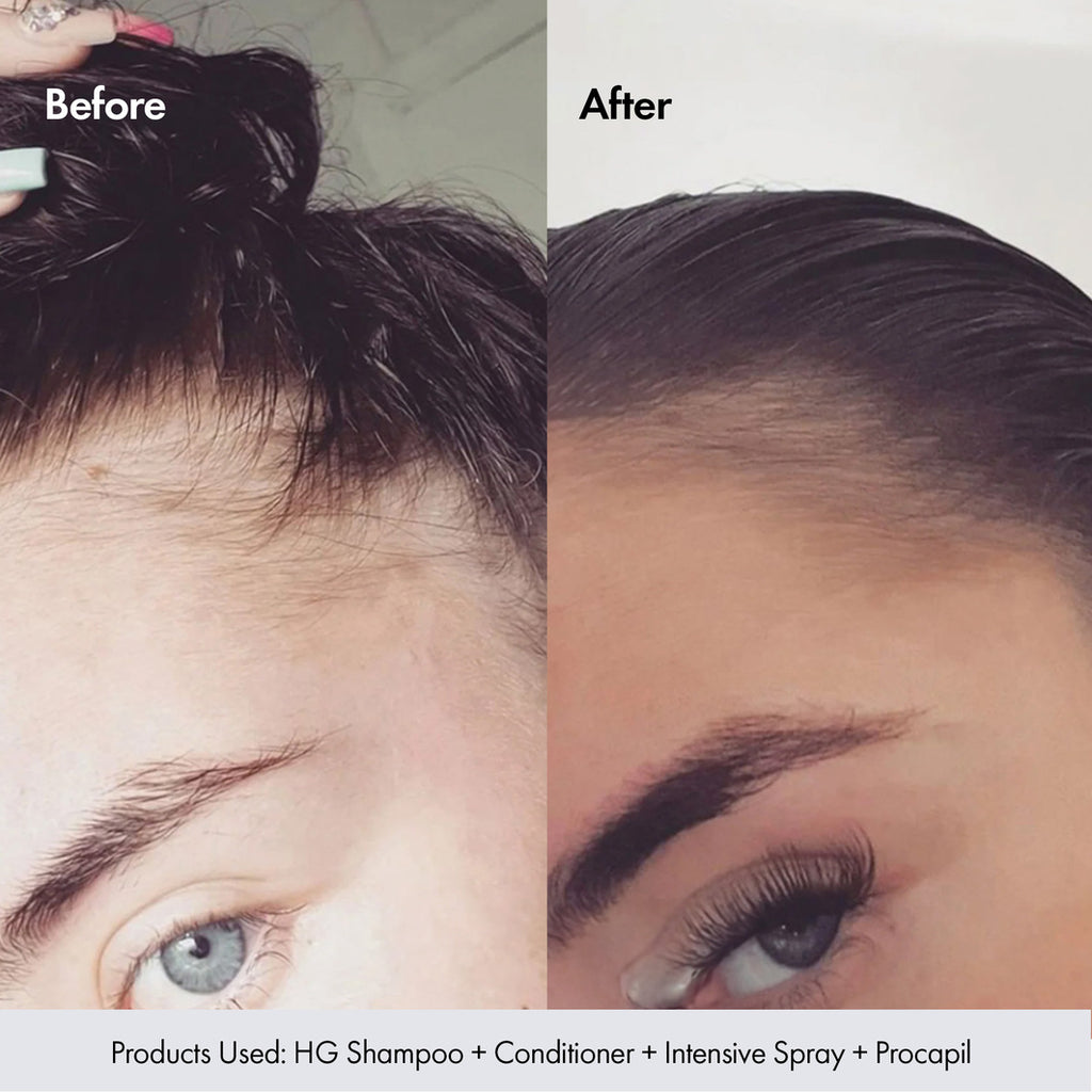 BondiBoost Procapil Hair Growth Tonic 125ml
