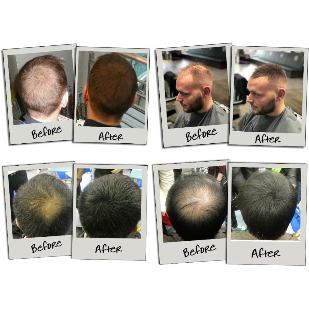 3D Hair Natural Hair Building Fibres For Thinning Hair Dark Brown 35g