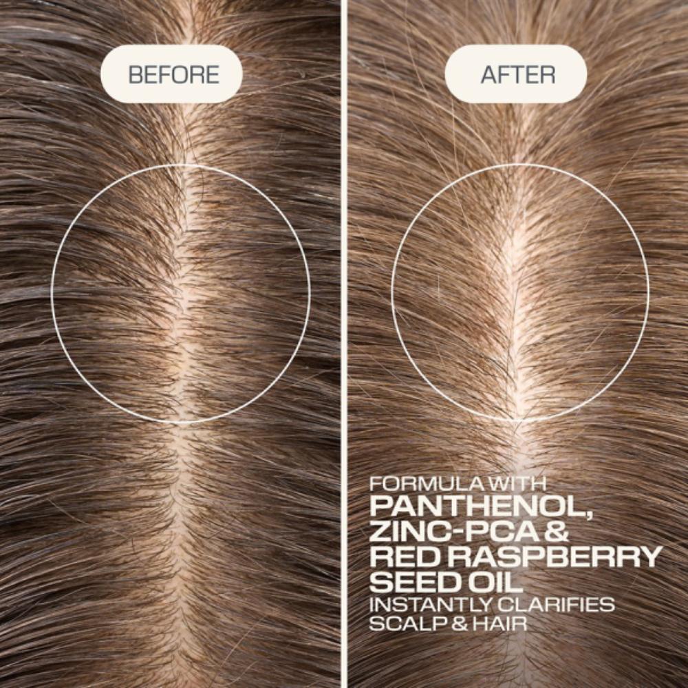 Goldwell Dualsenses Scalp Specialist Clarifying Shampoo 1000ml