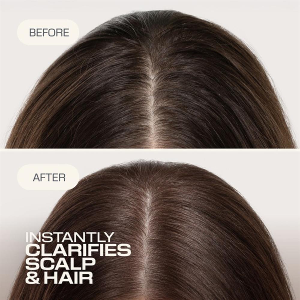 Goldwell Dualsenses Scalp Specialist Clarifying Shampoo 250ml
