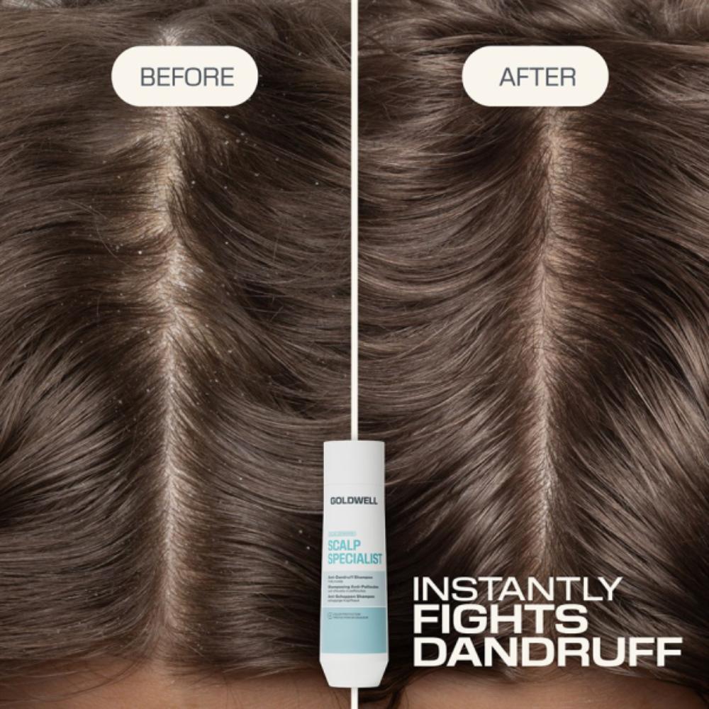 Goldwell Dualsenses Scalp Specialist Anti-Dandruff Shampoo 250ml