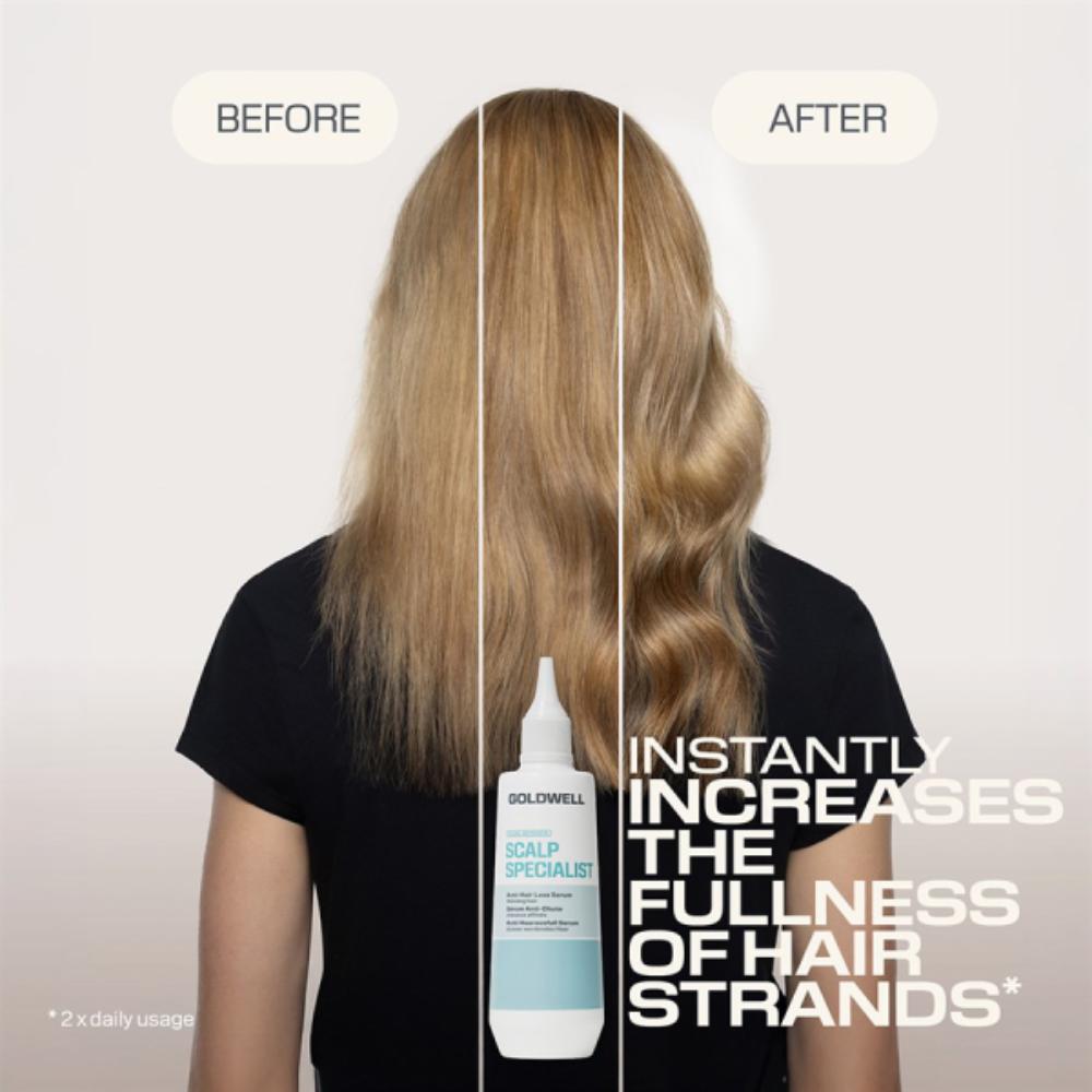 Goldwell Dualsenses Scalp Specialist Anti-Hair Loss Serum 150ml