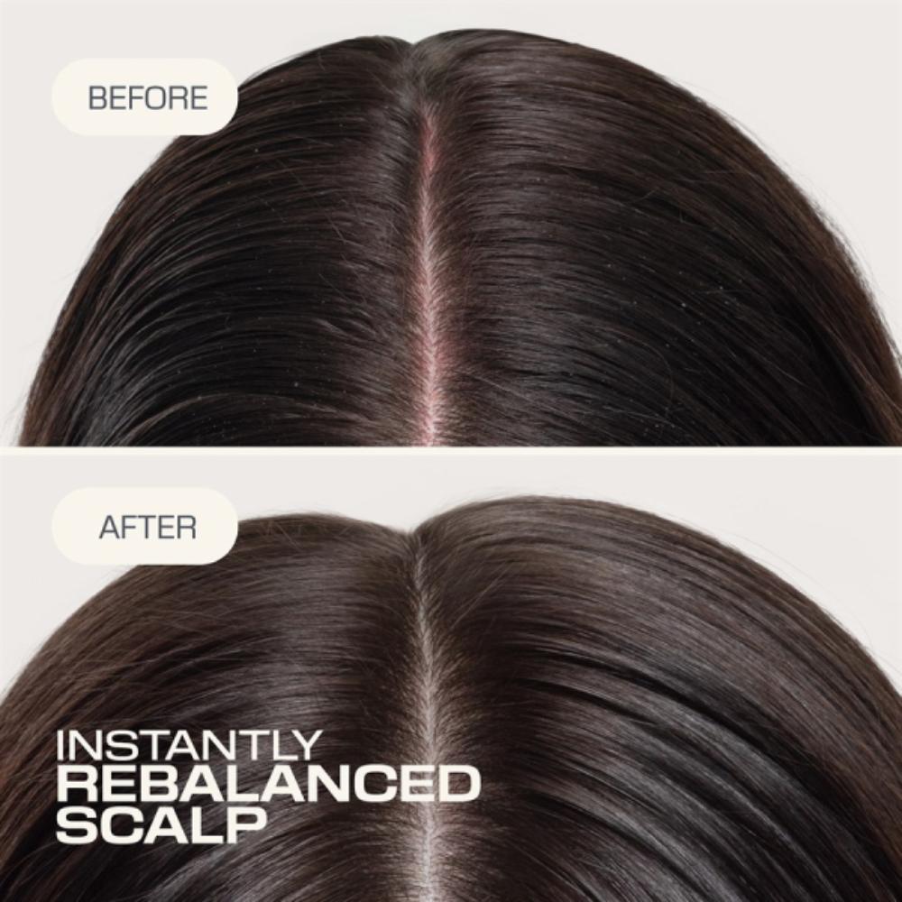Goldwell Dualsenses Scalp Specialist Rebalance & Hydrate Fluid 150ml