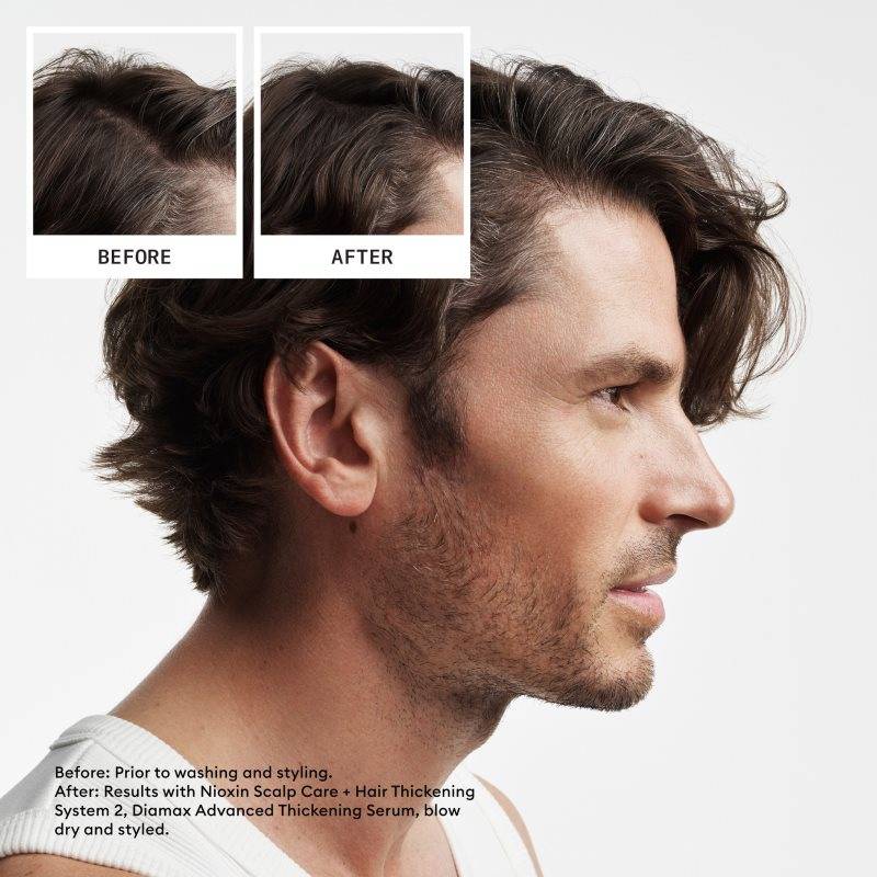 Nioxin System 2 Scalp + Hair Trial Kit for Progressed Thinning Natural Hair