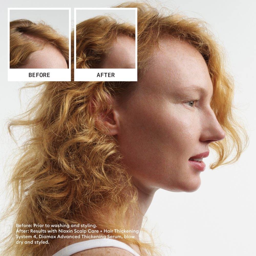 Nioxin System 4 Scalp + Hair Trial Kit for Progressed Thinning Coloured Hair