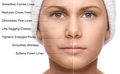 Micro-Needling Course (1 day intensive course)